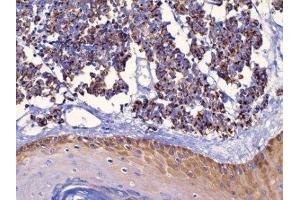 Immunohistochemistry (IHC) image for anti-Keratin 18 (KRT18) (C-Term) antibody (ABIN870569) (Cytokeratin 18 antibody  (C-Term))