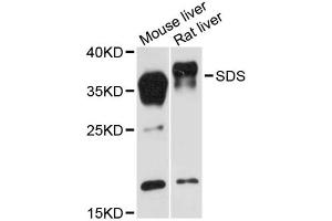 Western blot analysis of extracts of various cell lines, using SDS antibody (ABIN6293759) at 1:3000 dilution.