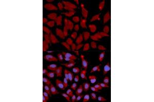 Immunofluorescence analysis of U2OS cell using DNMT3A antibody. (DNMT3A antibody  (AA 500-700))