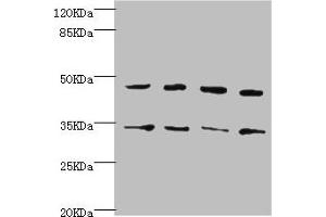Western blot All lanes: CYTH2 antibody at 5. (Cytohesin 2 antibody  (AA 150-350))