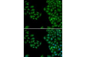 Immunofluorescence (IF) image for anti-Neurofilament, Light Polypeptide (NEFL) (AA 400-543) antibody (ABIN3020809)
