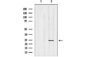 anti-RAB35, Member RAS Oncogene Family (RAB35) (Internal Region) antibody