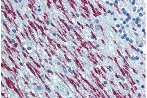 anti-Spastin (SPAST) (AA 200-305) antibody