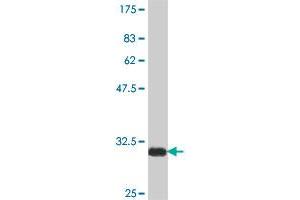 Western Blot detection against Immunogen (38. (NCOR2 antibody  (AA 1-110))