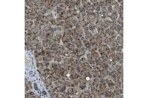 Immunohistochemical staining of human liver with APOBEC4 polyclonal antibody  shows strong granular positivity in hepatocytes.