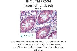 Image no. 2 for anti-Transmembrane Protease, serine 4 (TMPRSS4) (Internal Region) antibody (ABIN1740176) (TMPRSS4 antibody  (Internal Region))
