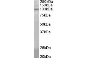 Western Blotting (WB) image for anti-ATP/GTP Binding Protein-Like 5 (AGBL5) (AA 137-149) antibody (ABIN1099865) (AGBL5 antibody  (AA 137-149))