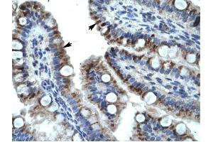 KRT15 antibody was used for immunohistochemistry at a concentration of 4-8 ug/ml to stain Epithelial cells of intestinal villus (arrows) in Human Intestine. (KRT15 antibody  (C-Term))
