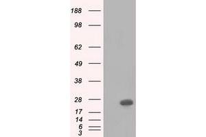 HEK293T cells were transfected with the pCMV6-ENTRY control (Left lane) or pCMV6-ENTRY BDH2 (Right lane) cDNA for 48 hrs and lysed. (BDH2 antibody)