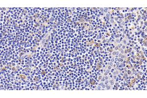 Detection of Bcl2 in Human Amygdalitis Tissue using Monoclonal Antibody to B-Cell Leukemia/Lymphoma 2 (Bcl2) (Bcl-2 antibody  (AA 2-211))