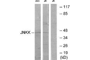 Western blot analysis of extracts from Jurkat cells and 293 cells, using JNKK antibody. (MAP2K4 antibody  (Internal Region))
