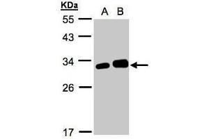 WB Image Sample(30 ug whole cell lysate) A:293T B:HeLa S3, 12% SDS PAGE antibody diluted at 1:1000 (Latexin antibody)