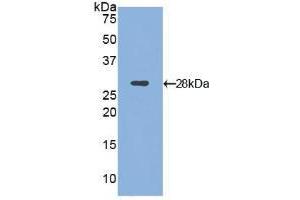 Western blot analysis of recombinant Mouse ITGaD.