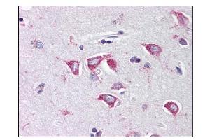 Image no. 1 for anti-Poly(rC) Binding Protein 4 (PCBP4) (C-Term) antibody (ABIN303232) (PCBP4 antibody  (C-Term))