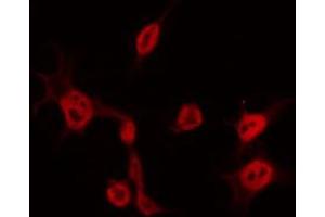 ABIN6267580 staining COS7 by IF/ICC. (CDK5 antibody  (pTyr15))