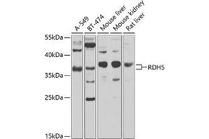 Western blot analysis of extracts of various cell lines, using RDH5 antibody (ABIN6130851, ABIN6146839, ABIN6146840 and ABIN6224076) at 1:1000 dilution. (RDH5 antibody  (AA 24-318))