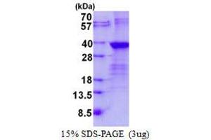 Image no. 1 for Lin-28 Homolog B (LIN28B) protein (His tag) (ABIN1098417)