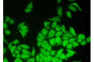 Detection of COTL1 in Hela cells using Polyclonal Antibody to Coactosin Like Protein 1 (COTL1) (COTL1 antibody  (AA 1-142))