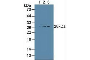 Figure. (Cathepsin S antibody  (AA 115-331))