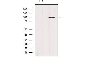 Western blot analysis of extracts from mouse brain, using MCM10 antibody.