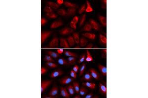 Immunofluorescence analysis of U2OS cells using FKBP4 antibody (ABIN5973289). (FKBP4 antibody)