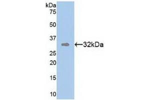 Detection of Recombinant TR1, Human using Polyclonal Antibody to Tomoregulin 1 (TR1) (TMEFF1 antibody  (AA 79-333))