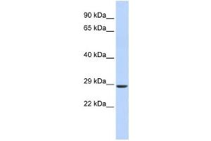 Western Blotting (WB) image for anti-SIX Homeobox 2 (SIX2) antibody (ABIN2458374) (SIX2 antibody)