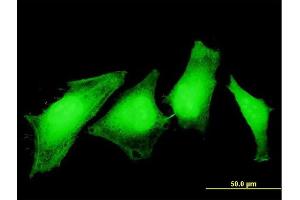 Immunofluorescence of monoclonal antibody to ASPA on HeLa cell. (ASPA antibody  (AA 1-100))