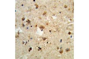 Immunohistochemistry (IHC) image for anti-Activating Transcription Factor 6 (ATF6) (AA 350-377) antibody (ABIN3028449)