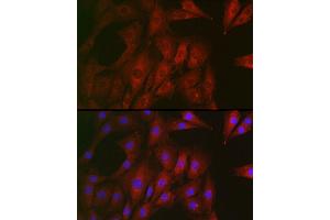 Immunofluorescence analysis of NIH/3T3 cells using RTKN Rabbit pAb (ABIN6129097, ABIN6147290, ABIN6147292 and ABIN6222455) at dilution of 1:100 (40x lens). (Rhotekin antibody  (AA 254-513))