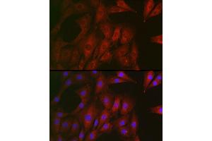 Immunofluorescence analysis of NIH/3T3 cells using RTKN Rabbit pAb (ABIN6129097, ABIN6147290, ABIN6147292 and ABIN6222455) at dilution of 1:100 (40x lens). (Rhotekin antibody  (AA 254-513))