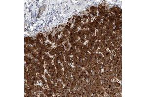 Immunohistochemical staining (Formalin-fixed paraffin-embedded sections) of human liver with SLC22A7 polyclonal antibody  shows strong granular cytoplasmic positivity in hepatocytes. (SLC22A7 antibody)