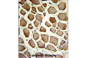 Formalin-fixed and paraffin-embedded human skeletal muscle reacted with CKIP-1 Antibody (N-term), which was peroxidase-conjugated to the secondary antibody, followed by DAB staining. (PLEKHO1 antibody  (N-Term))