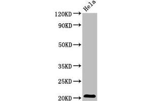 Western Blot Positive WB detected in: Hela whole cell lysate All lanes: ARL1 antibody at 5. (ARL1 antibody  (AA 2-181))