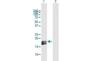 Western Blot analysis of IFNA1 expression in transfected 293T cell line by IFNA1 MaxPab polyclonal antibody.