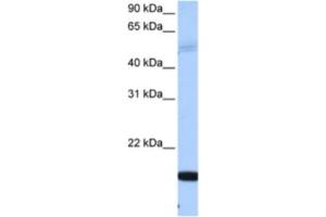 Western Blotting (WB) image for anti-Smith-Magenis Syndrome Chromosome Region, Candidate 7-Like (SMCR7L) antibody (ABIN2463440) (SMCR7L antibody)