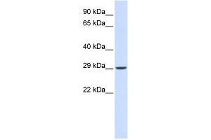 VTI1A antibody used at 1 ug/ml to detect target protein. (VTI1A antibody)