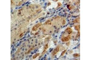 Used in DAB staining on fromalin fixed paraffin-embedded Stomach tissue (Neuromedin U antibody  (AA 38-174))