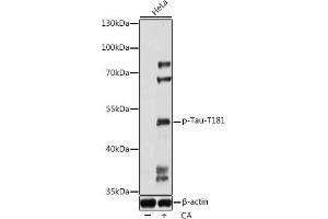 Western blot analysis of extracts of HeLa cells, using Phospho-Tau-T181 antibody (ABIN7268528) at 1:1000 dilution. (MAPT antibody  (pThr181))