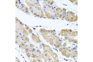 Immunohistochemistry of paraffin-embedded human gastric using OGFR antibody at dilution of 1:100 (x40 lens). (OGFR antibody)