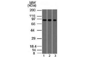 Western blot testing of human 1) A549, 2) HepG2 and 3) HCT-116 cell lysate with Villin antibody (clone VIL1/1314). (Villin 1 antibody  (AA 179-311))