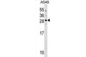Western Blotting (WB) image for anti-Guanylate Cyclase Activator 1B (Retina) (GUCA1B) antibody (ABIN3000950) (GUCA1B antibody)