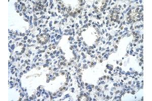 Rabbit Anti-RASSF7 Antibody       Paraffin Embedded Tissue:  Human alveolar cell   Cellular Data:  Epithelial cells of renal tubule  Antibody Concentration:   4. (RASSF7 antibody  (Middle Region))