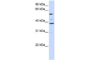 SLC25A16 antibody used at 1 ug/ml to detect target protein. (SLC25A16 antibody)