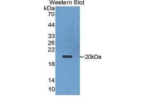Figure. (POMP antibody  (AA 1-141))