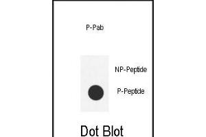 Dot blot analysis of anti-Phospho-SRC- Phospho-specific Pab (ABIN650803 and ABIN2839787) on nitrocellulose membrane.