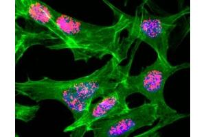 ICC/IF staining of HeLa cells treated with sodium butyrate using recombinant H3K23ac antibody (red). (Recombinant Histone 3 antibody  (H3K23ac))