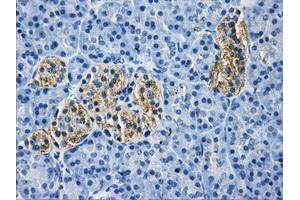 Immunohistochemical staining of paraffin-embedded liver tissue using anti-HDAC10mouse monoclonal antibody. (HDAC10 antibody)