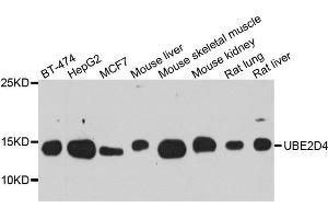 Western blot analysis of extract of various cells, using UBE2D4 antibody. (UBE2D4 antibody)