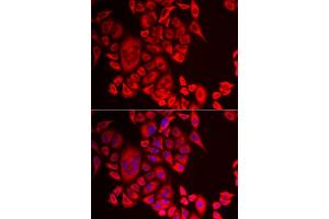 Immunofluorescence analysis of MCF-7 cells using QPCT antibody (ABIN6131418, ABIN6146535, ABIN6146536 and ABIN6222426). (QPCT antibody  (AA 1-361))